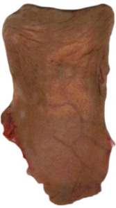 Foreskin